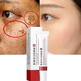 Aufhellende Sommersprossen-Creme -Pigmentierungs-Entfernungscreme für das Gesicht -Behandlungscreme zur Entfernung von Aknenarben -Anti-Falten-Effektive Entfernen Melasma Melanin dunkle Fleck