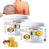 Bienengift Psoriasis Creme, Bienengift Creme Psoriasis Bienengiftsalbe Gegen Schmerzen, Bee Venom Ointment, Bee Cream Bienengiftsalbe, Bienengiftlinderungscreme, Bienengift Salbe Psoriasis C